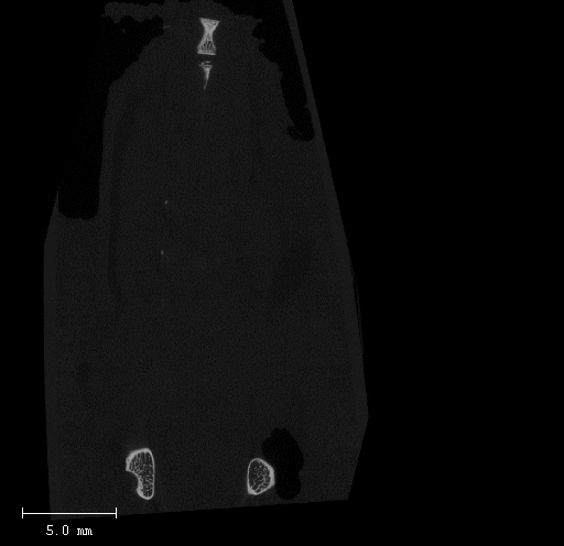 MicroCT scan of a mouse lower spine showing coronal cross-section of a lumbo-sacral spine (L1-sacrum) scan.